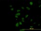 CDK5RAP3 Antibody (monoclonal) (M01)